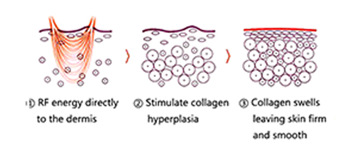 Portable Oxygen Facial Machine For Home Use | PrettyLasers (8) Portable Oxygen Facial Machine For Home Use | PrettyLasers (8)